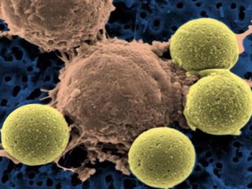 Fine Tuned Car T Cells Article Sourcenci
