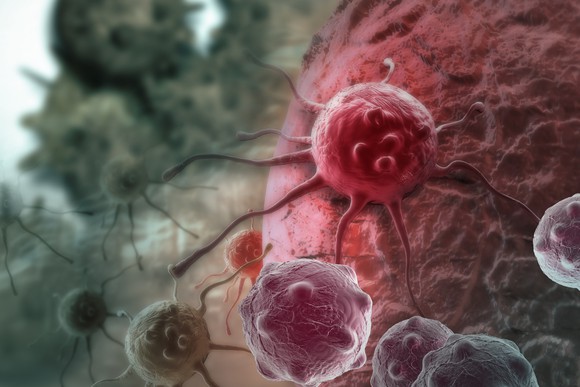 Blood Cancer