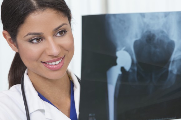 Doctor examining hip replacement X-ray.