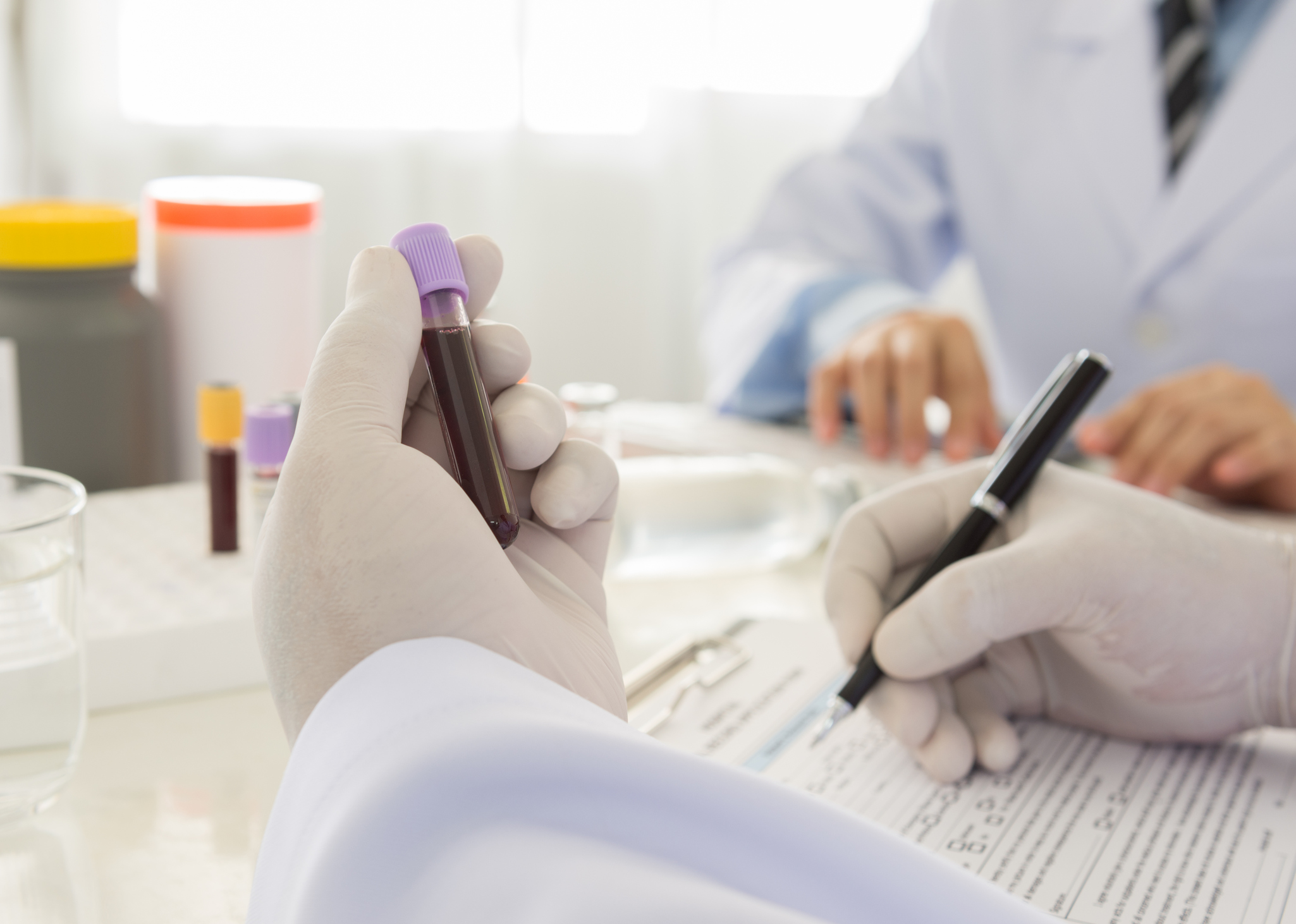 A lab researcher examining a blood sample and making notes.