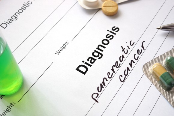 Paper with "Diagnosis: pancreatic cancer" written on it