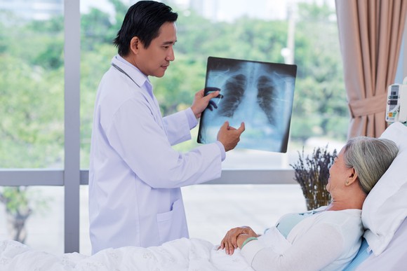 Doctor showing a patient a chest x-ray