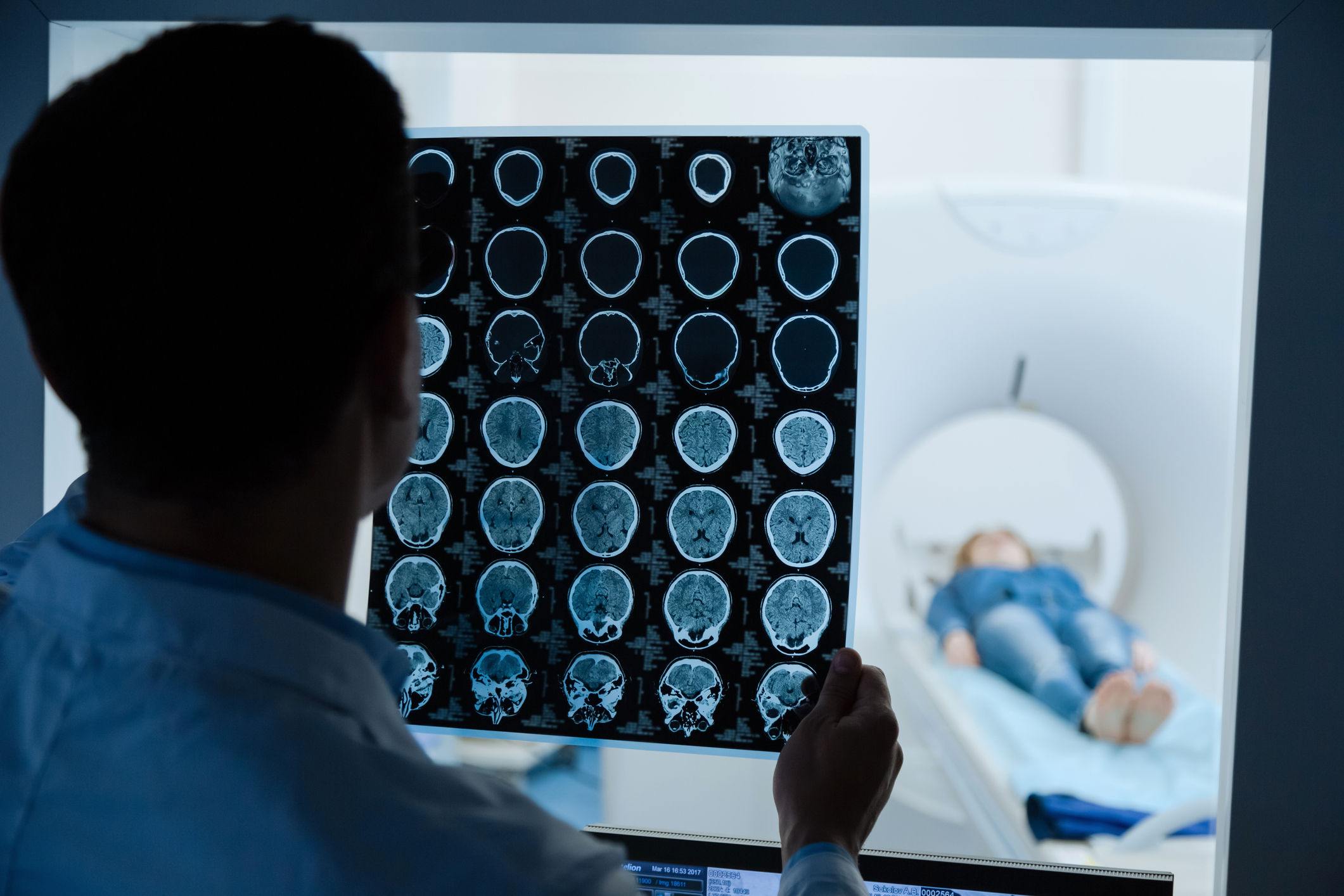 Professional male oncologist looking at the MRI scan image.