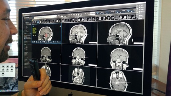 Pathologist reviews medical images on lighted panel.