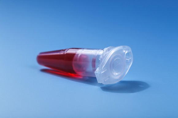 Blood in a tube