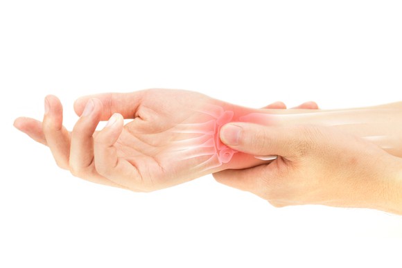 Wrist with arthritis pain