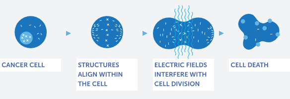graphic of TTFields effect on cancerous cell