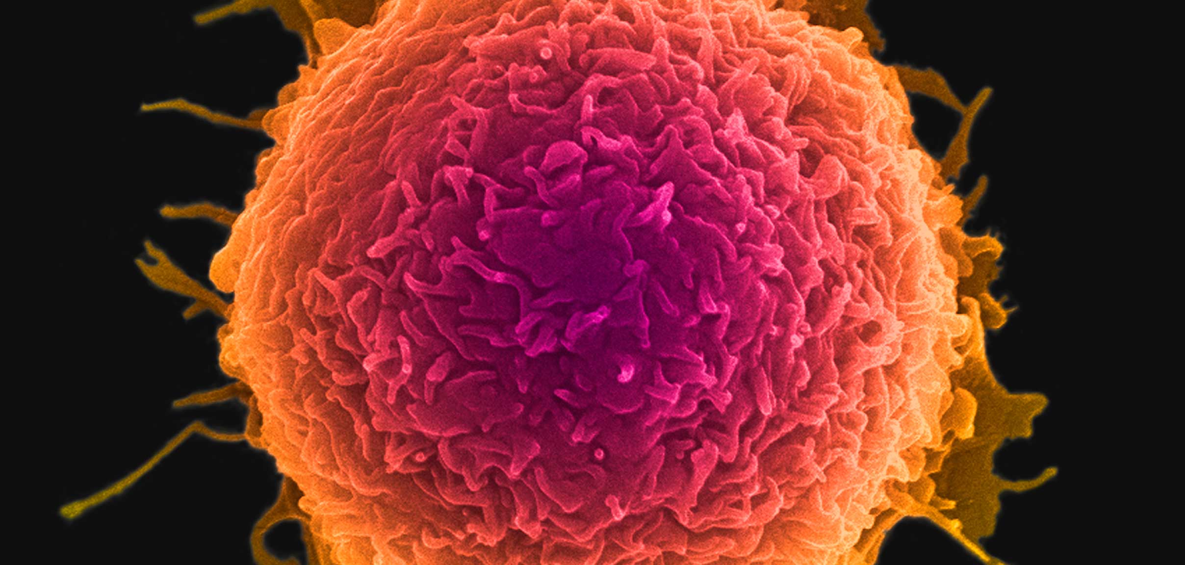 Cancer cell