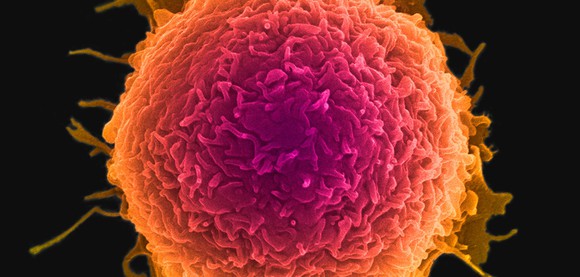 Cancer cell
