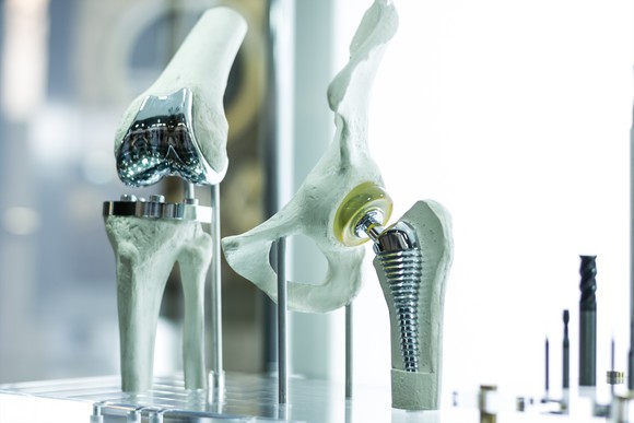 Artificial knee and hip replacement joints