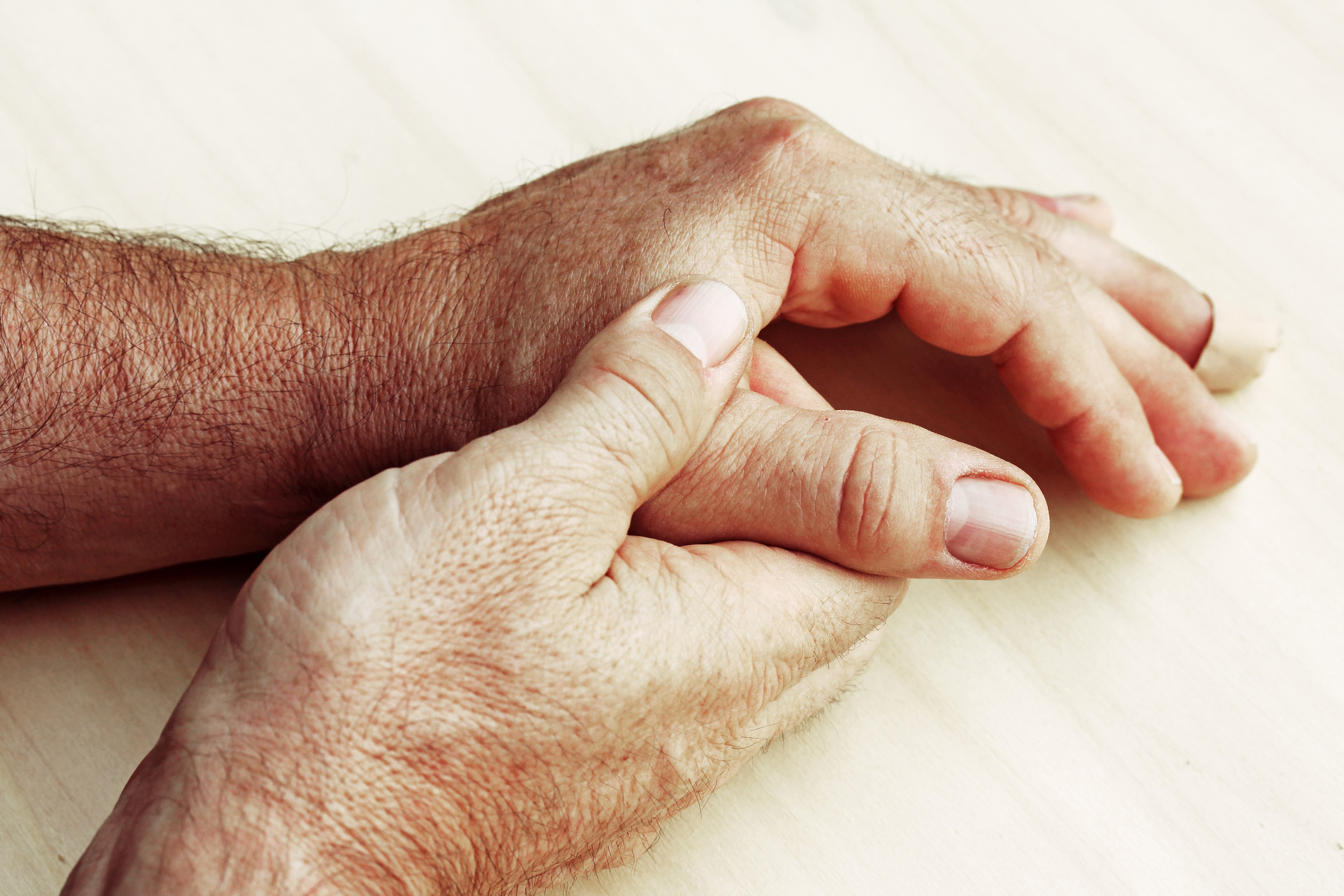 Arthritic hands