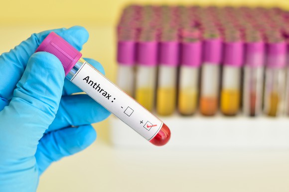 Gloved hand holding an anthrax-positive blood sample.