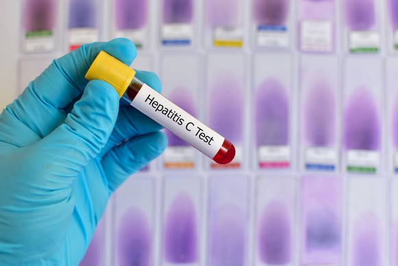 A gloved hand holding a capped tube with a label that says "Hepatitis C Test" on it