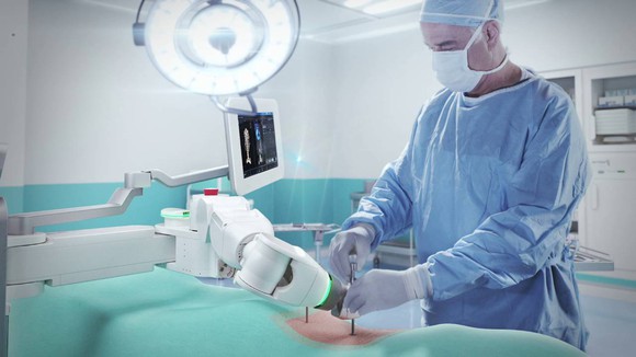 A surgeon performs a spine surgery using a Mazor X system.