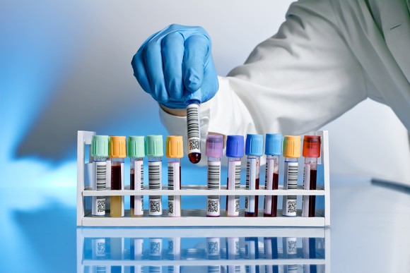Blood samples with bar codes.