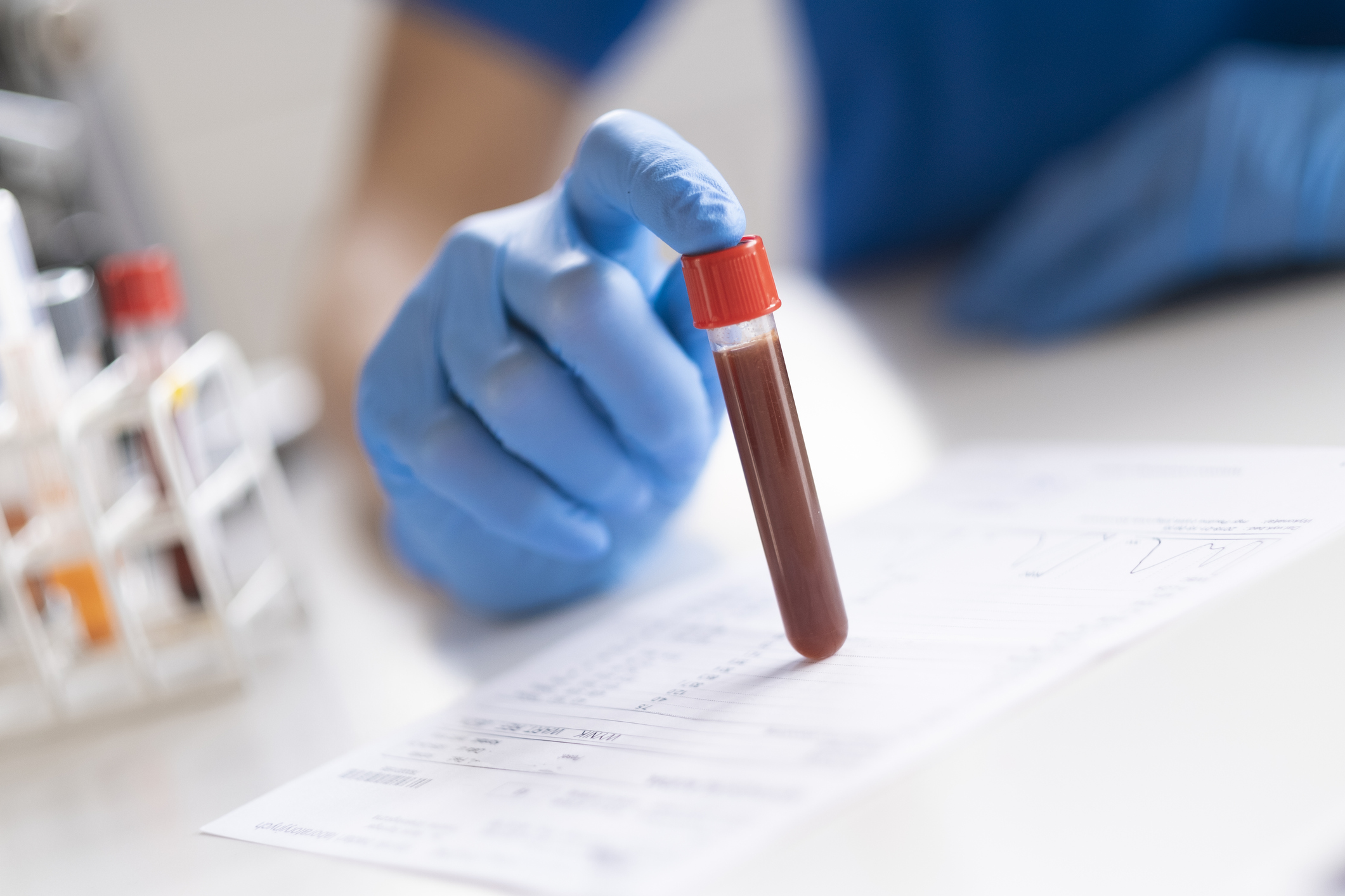 Hand holding vial of blood in lab