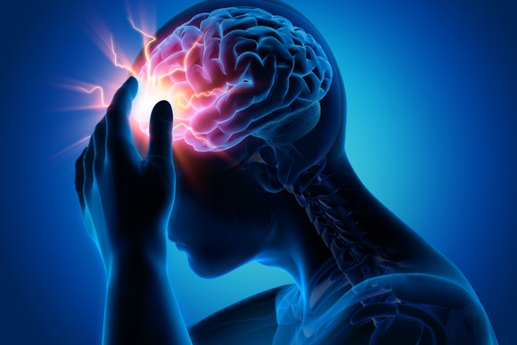 Image of a man holding head with sparks coming from brain.