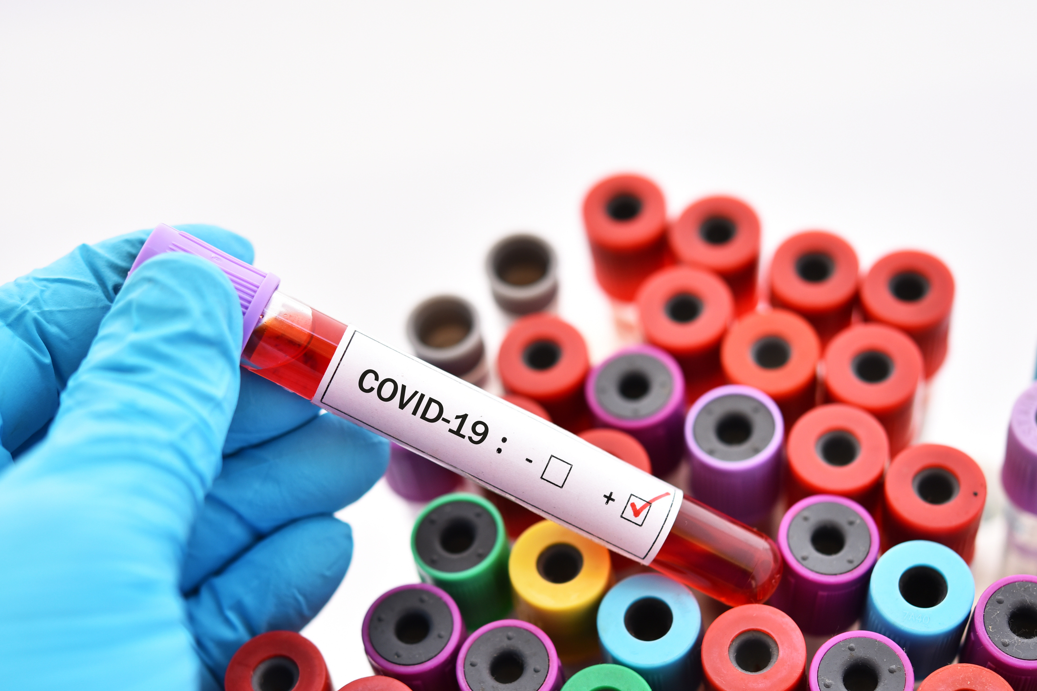 COVID-19 test blood sample