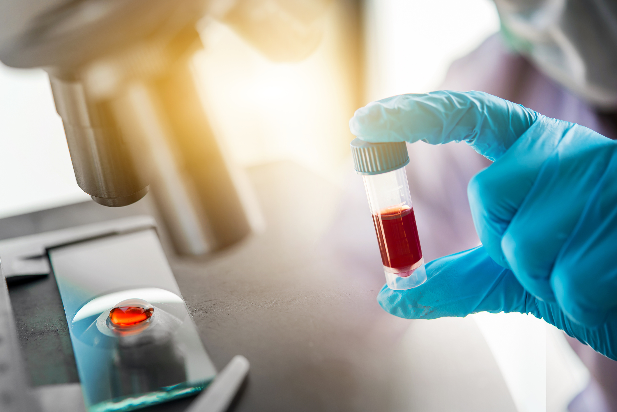 Gloved hand holding a vial of blood next to a microscope