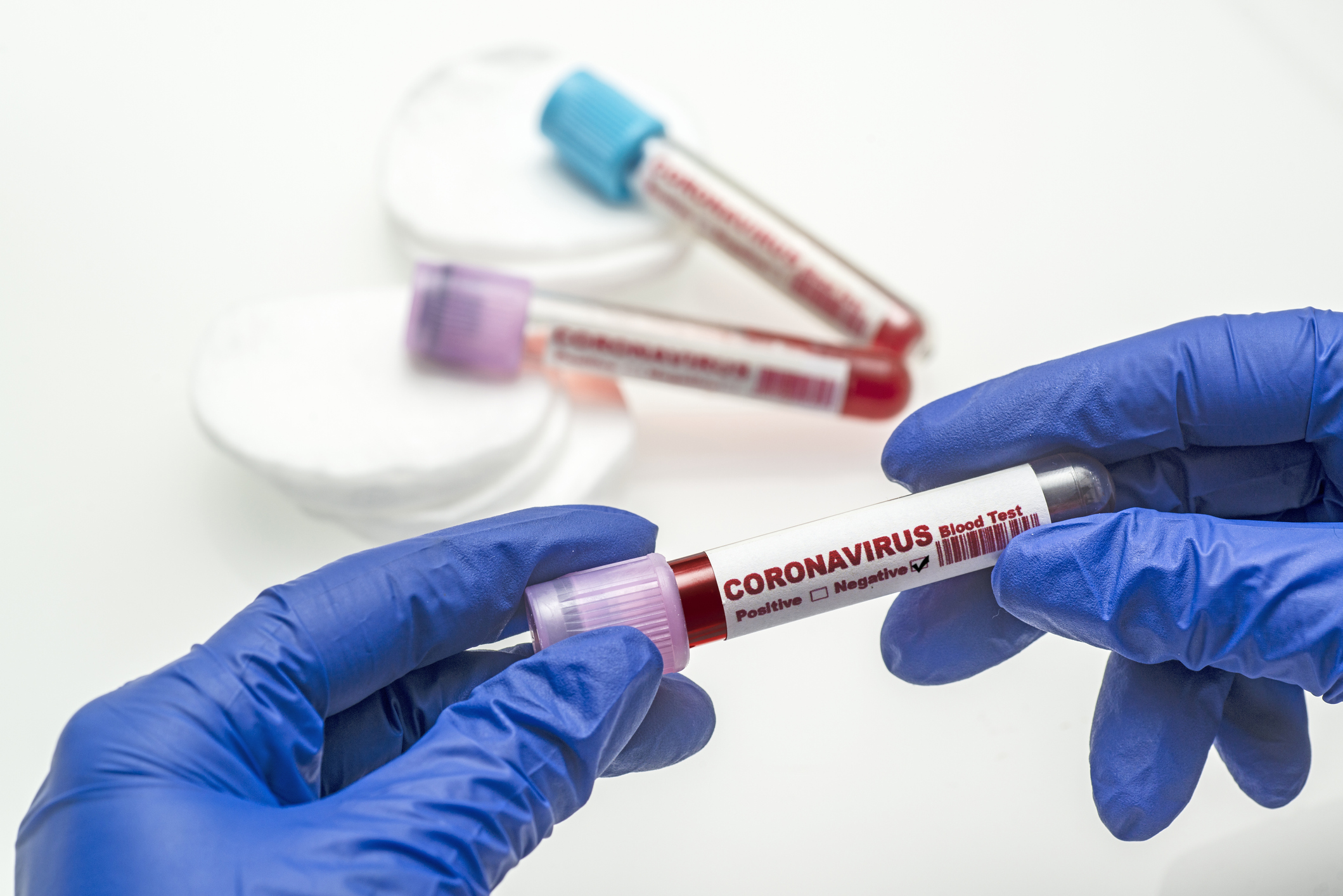A scientist with gloved hands holds a coronavirus blood sample.