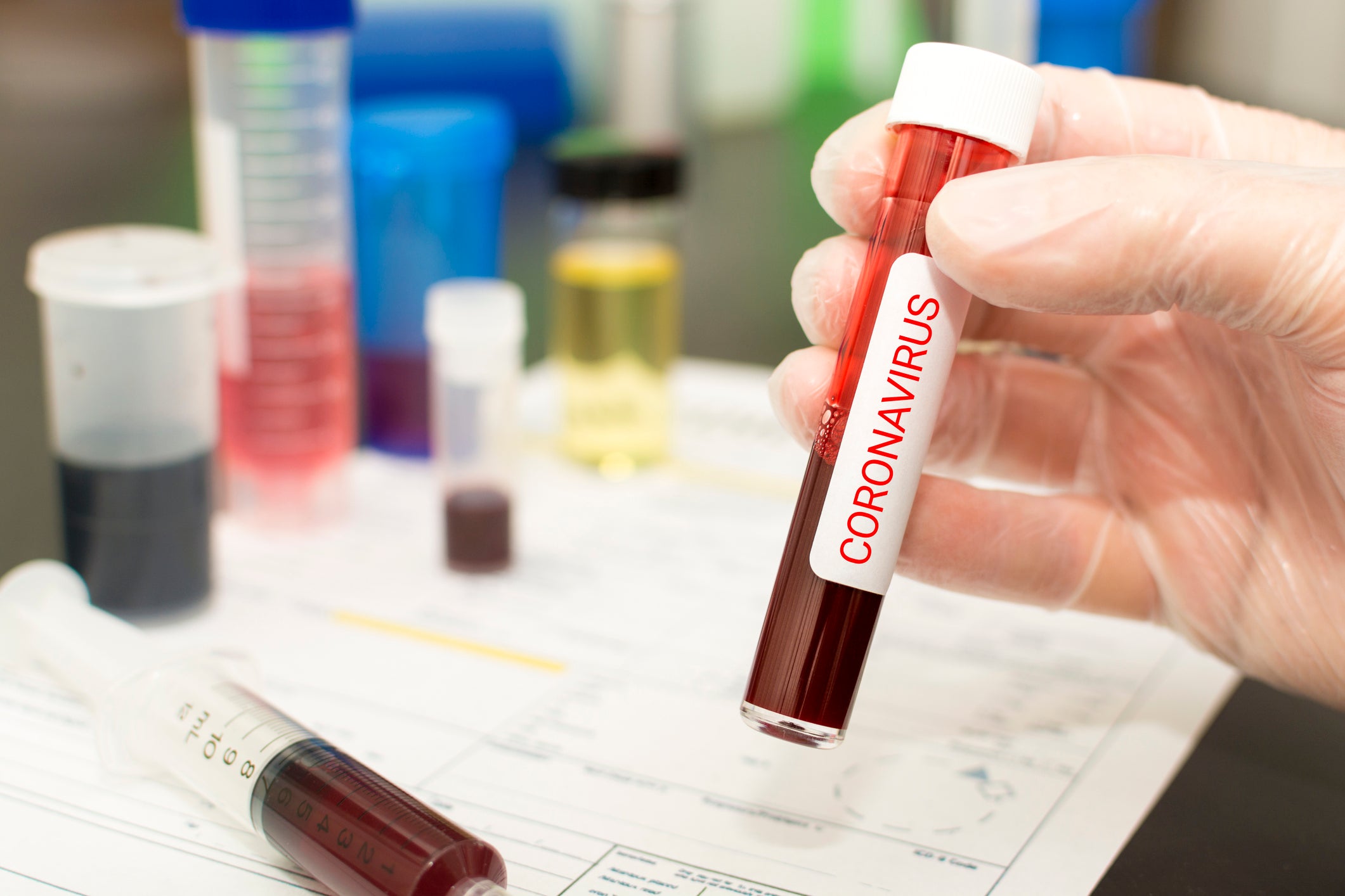 Gloved hand holding coronavirus blood vial.
