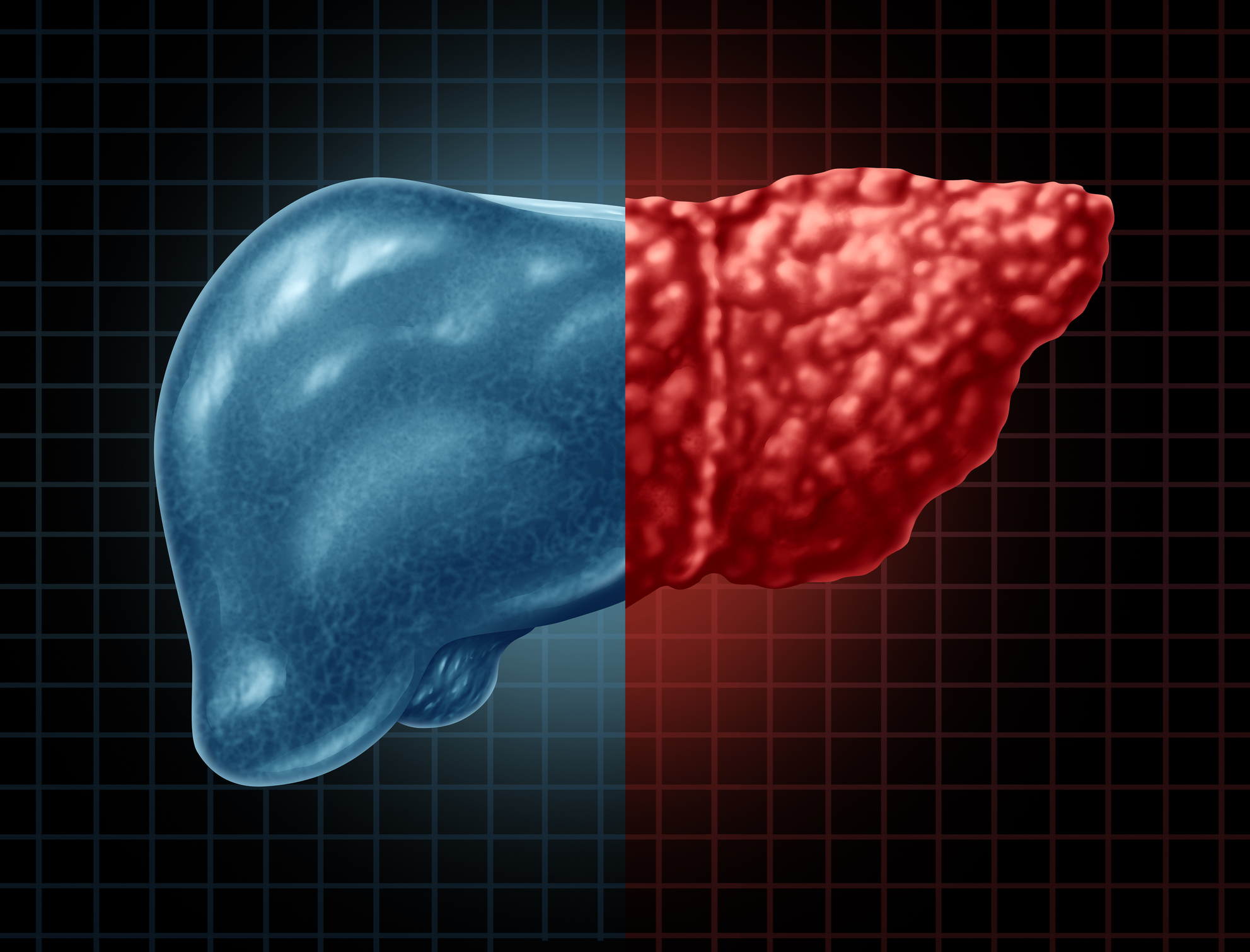 A human liver illustrating the difference between a healthy liver and a fibrotic one.