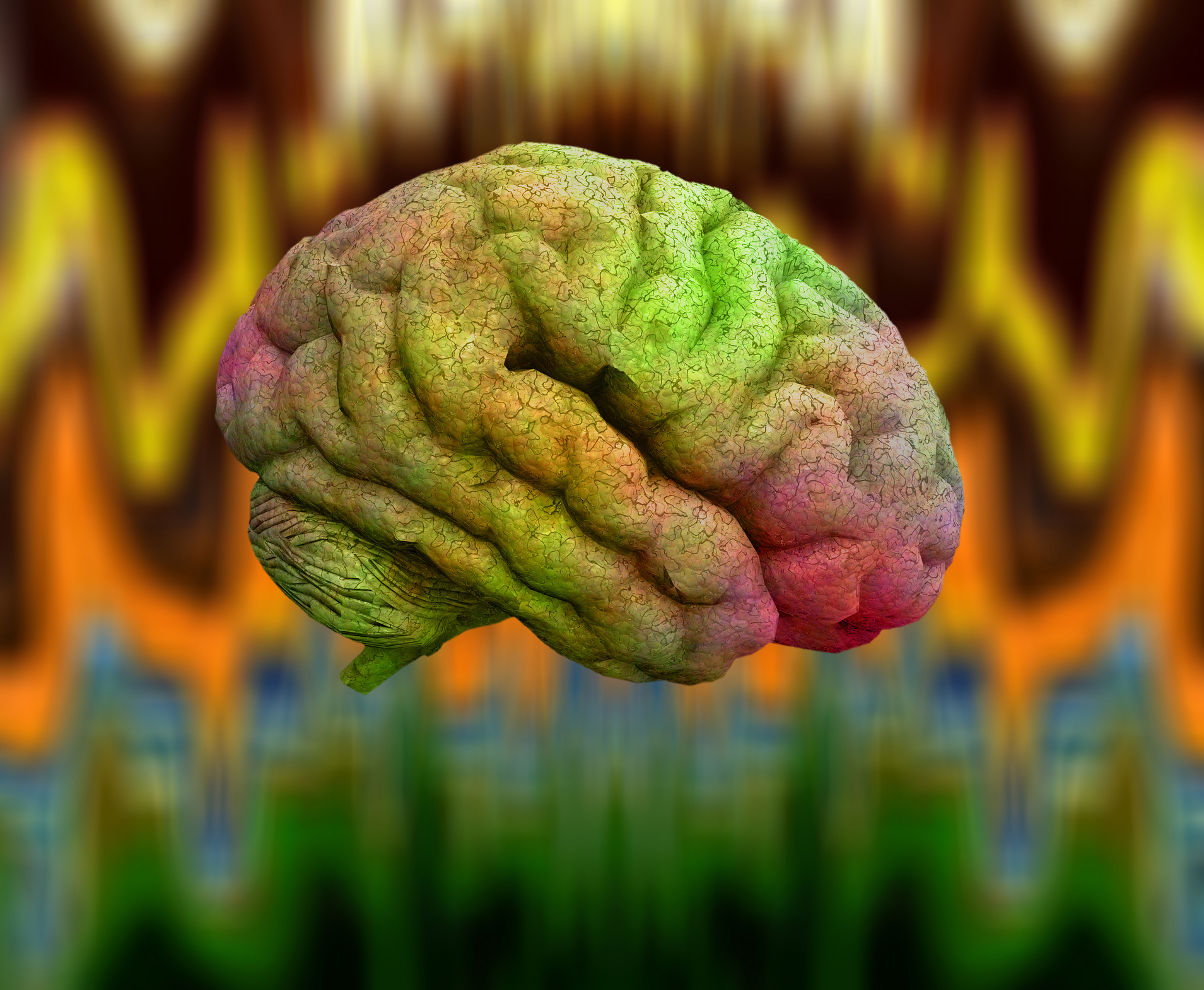 A multi-colored human brain.