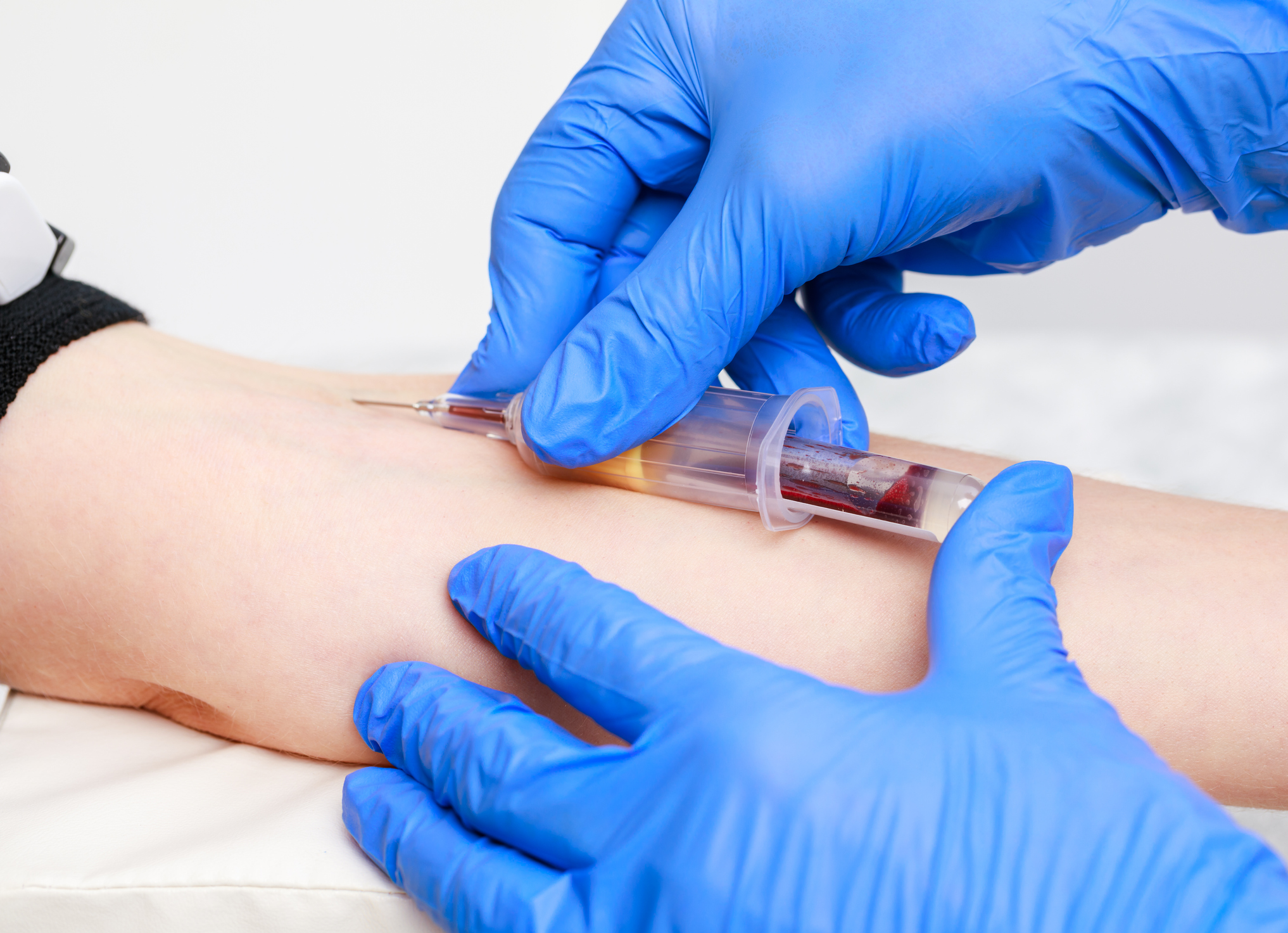 Has Guardant Health Lived Up to the Hype?