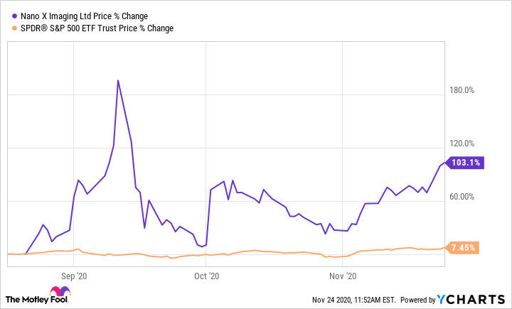 stock chart Nano-X
