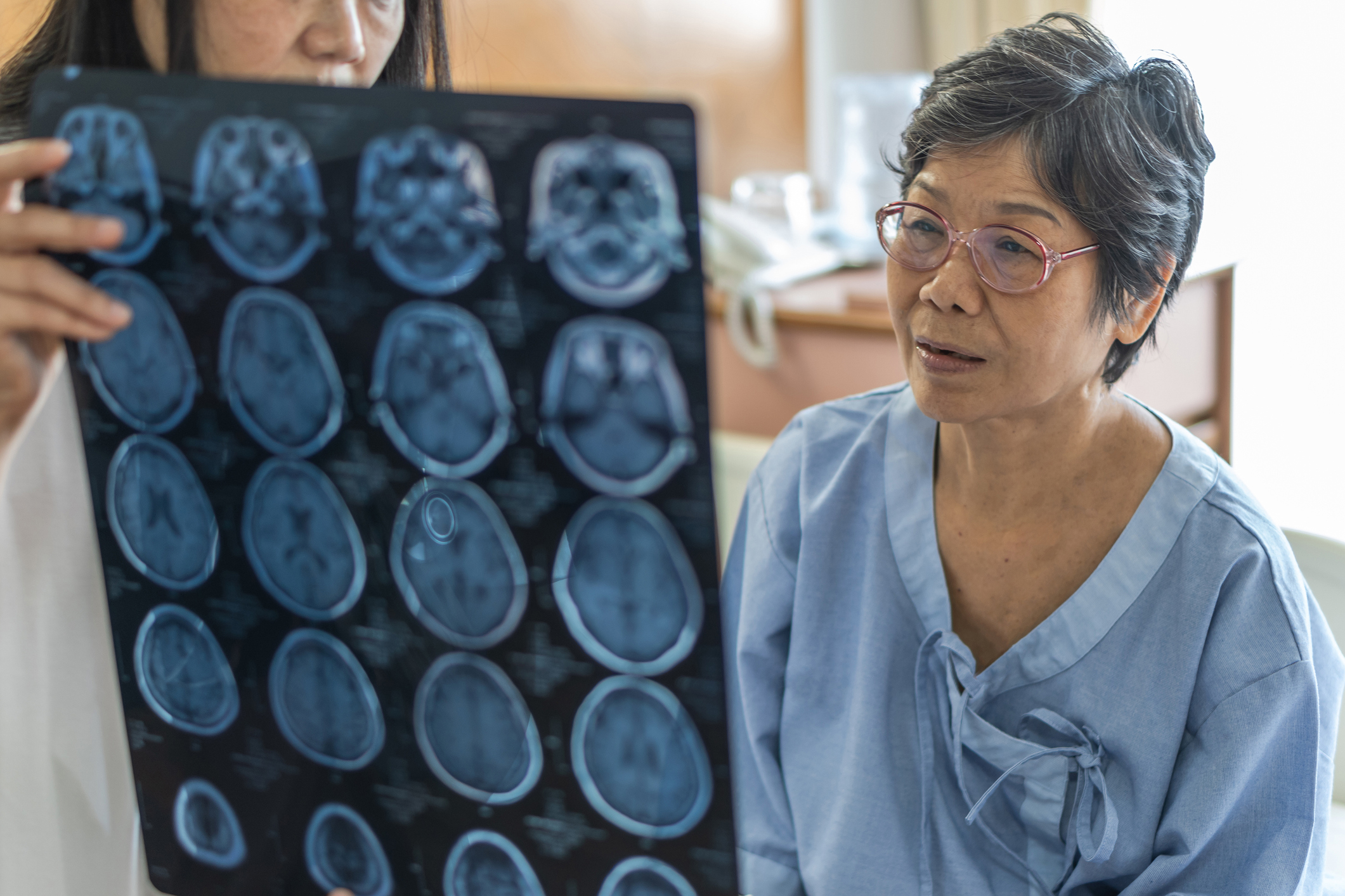 A lady in a hospital gown looking at brain scans that her doctor is holding.