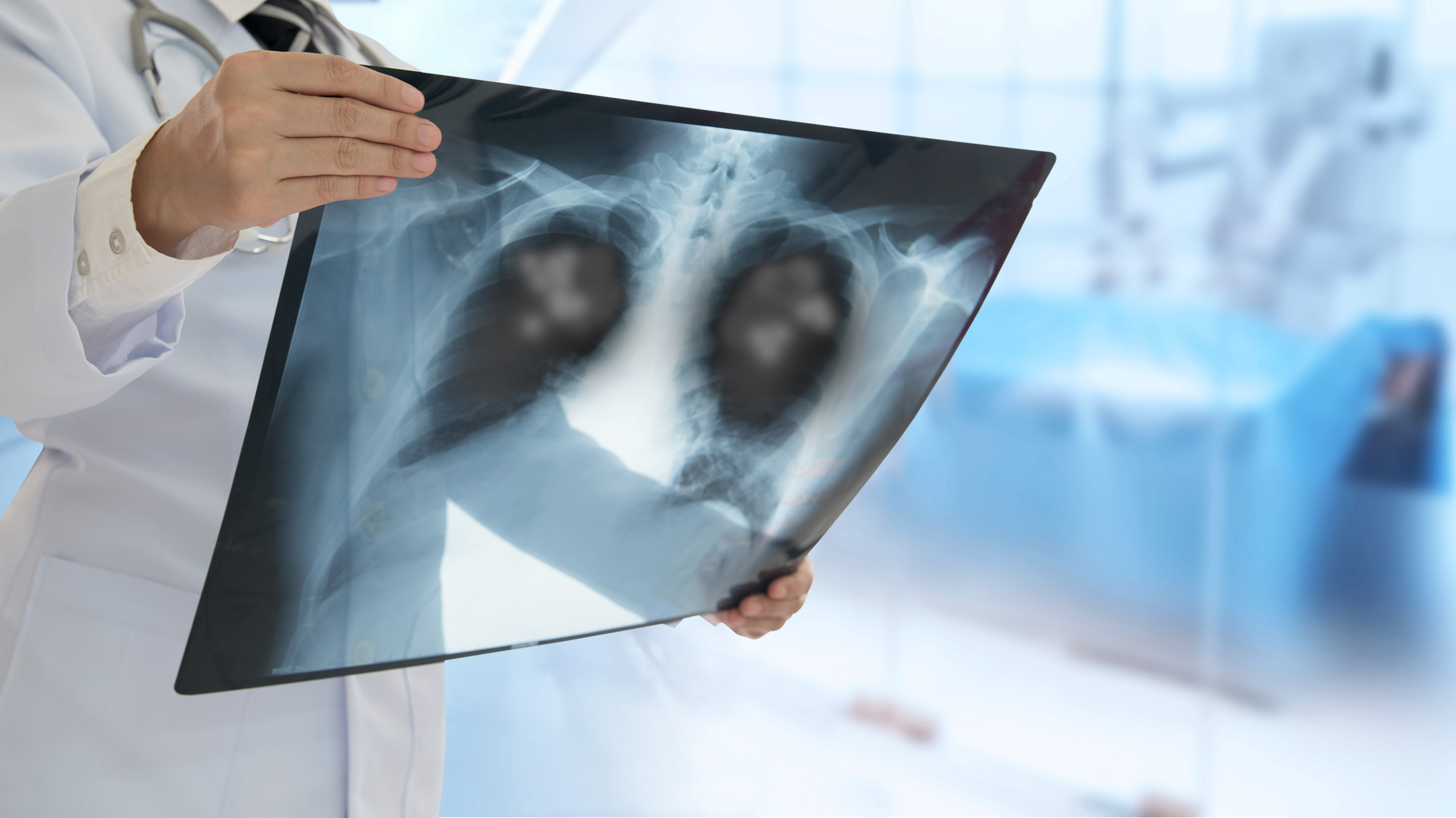 getty-lung-cancer
