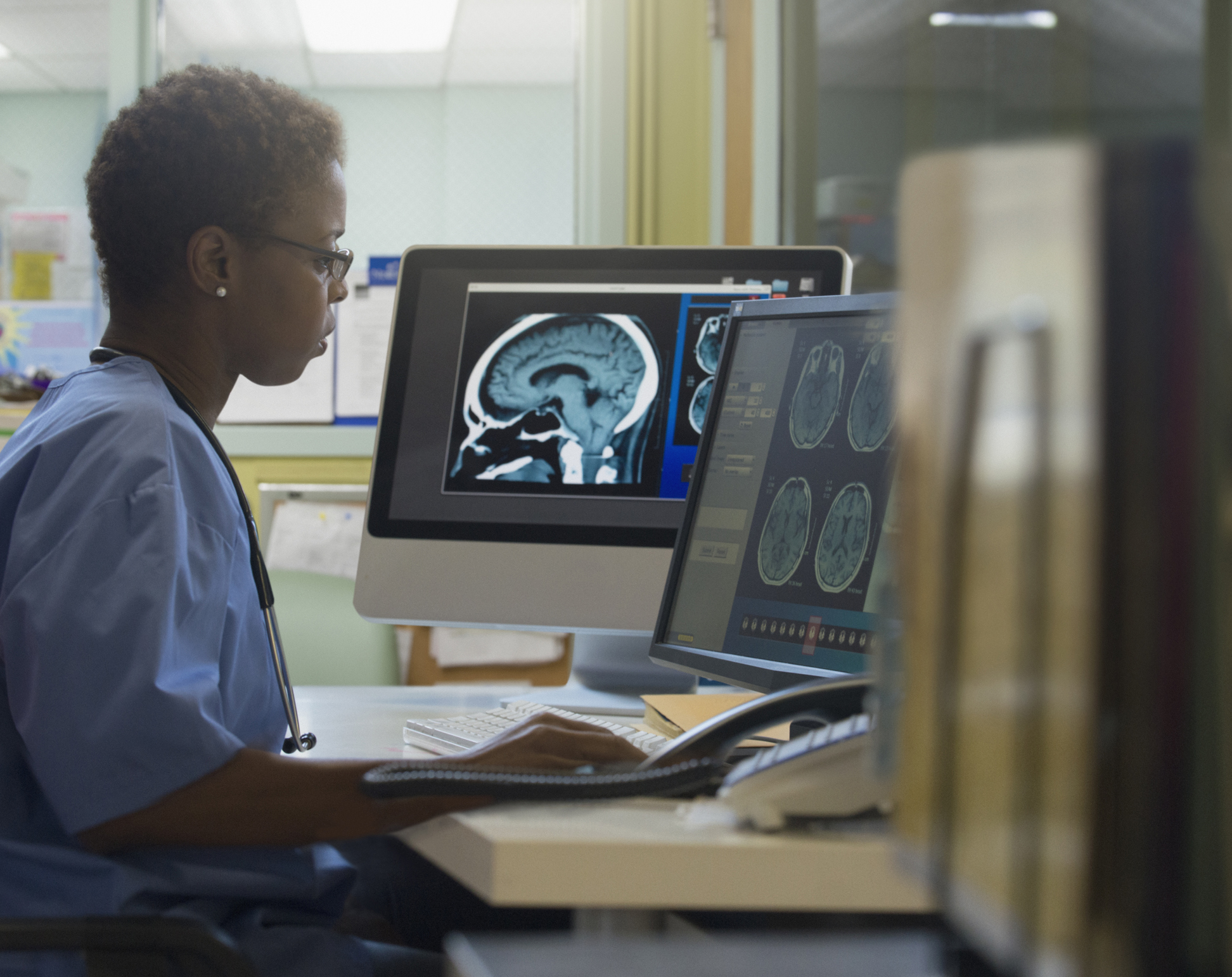 Doctor looking at a brain scan.
