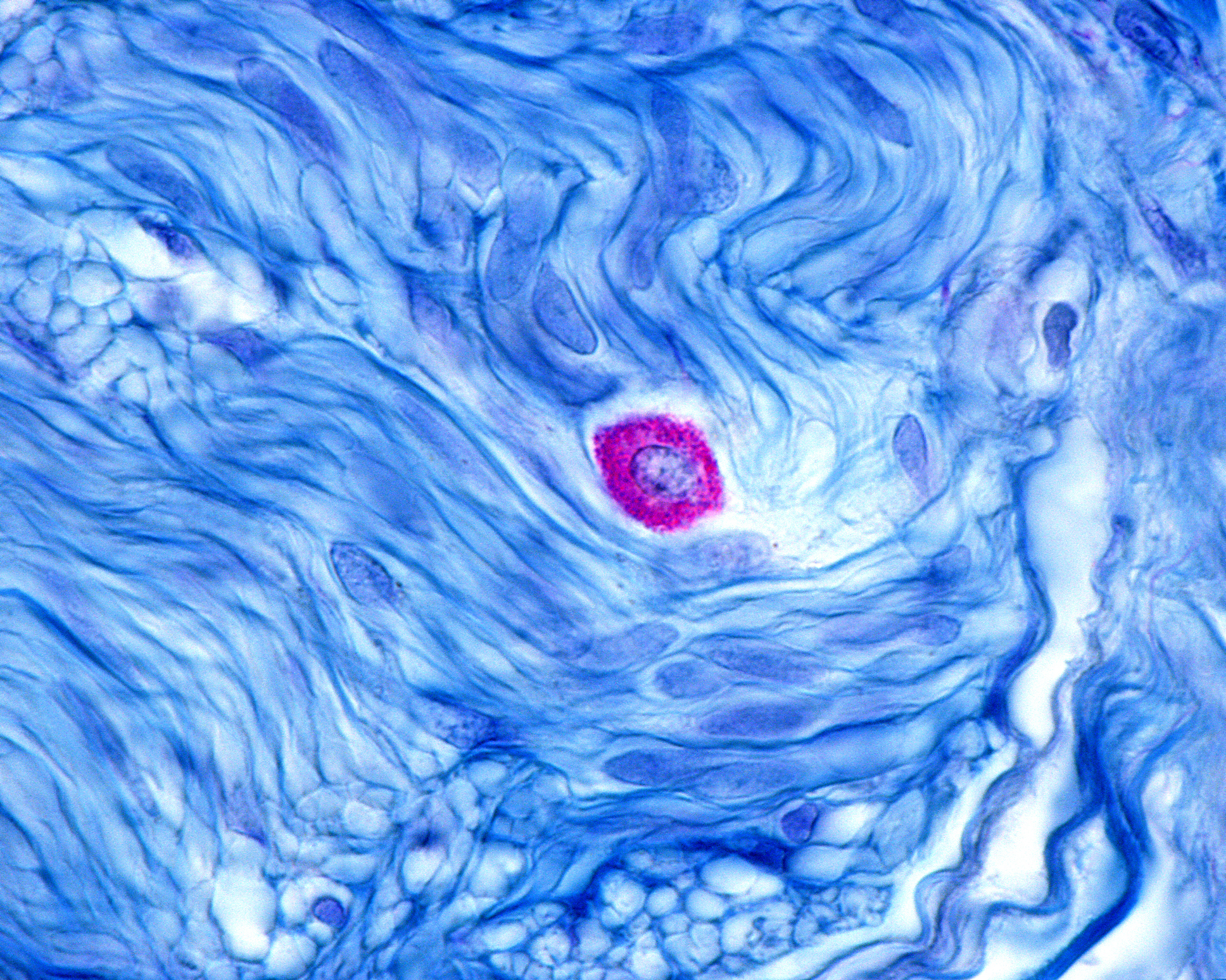 A mast cell.