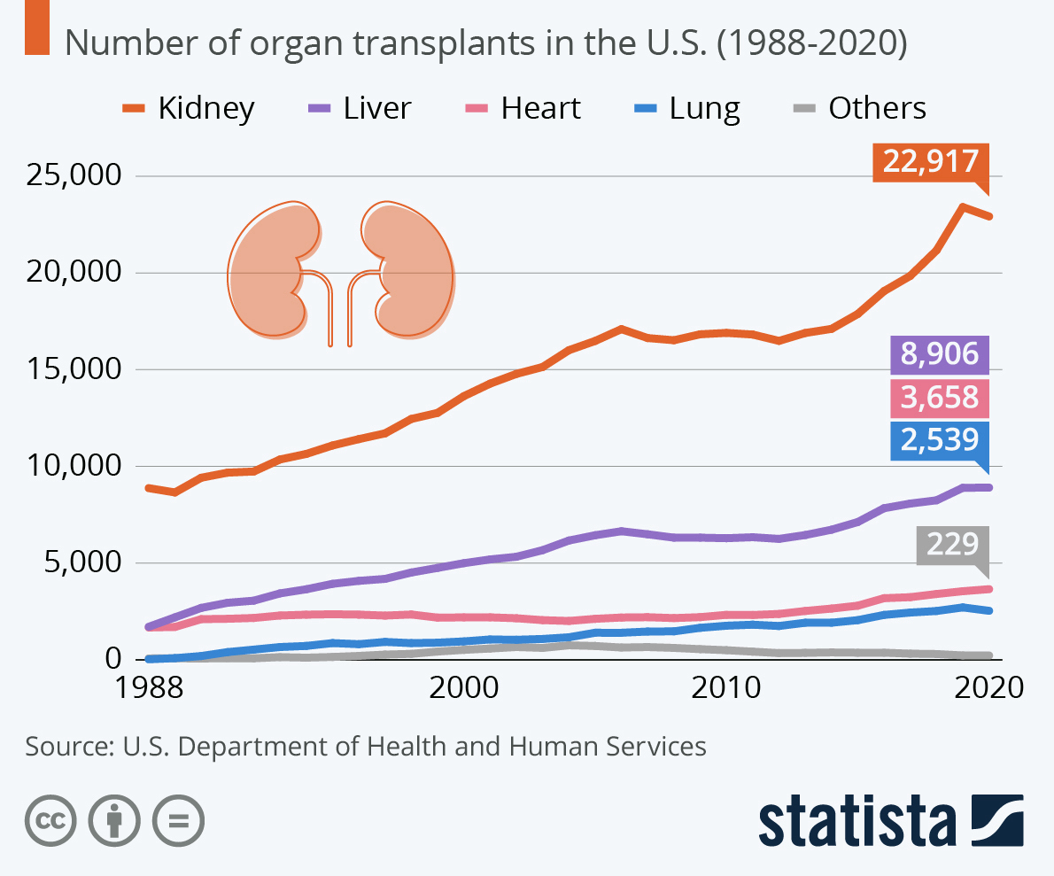 A chart depicting the number of organ transplants in the U.S. Kidney transplants are on the rise.