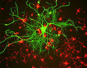 306px-Neuron_in_tissue_culture