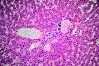 Human liver tissue