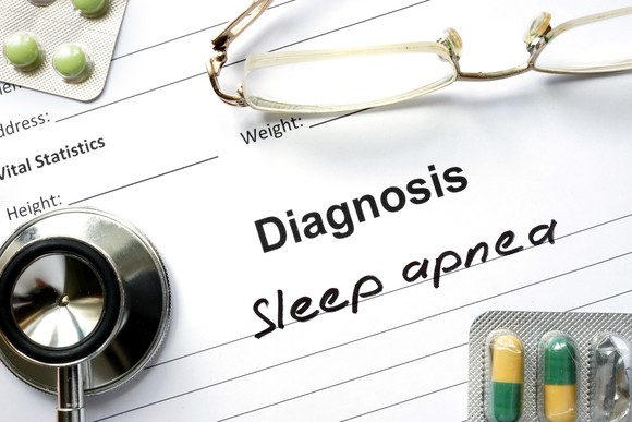 A written diagnosis of sleep apnea next to a stethoscope. 