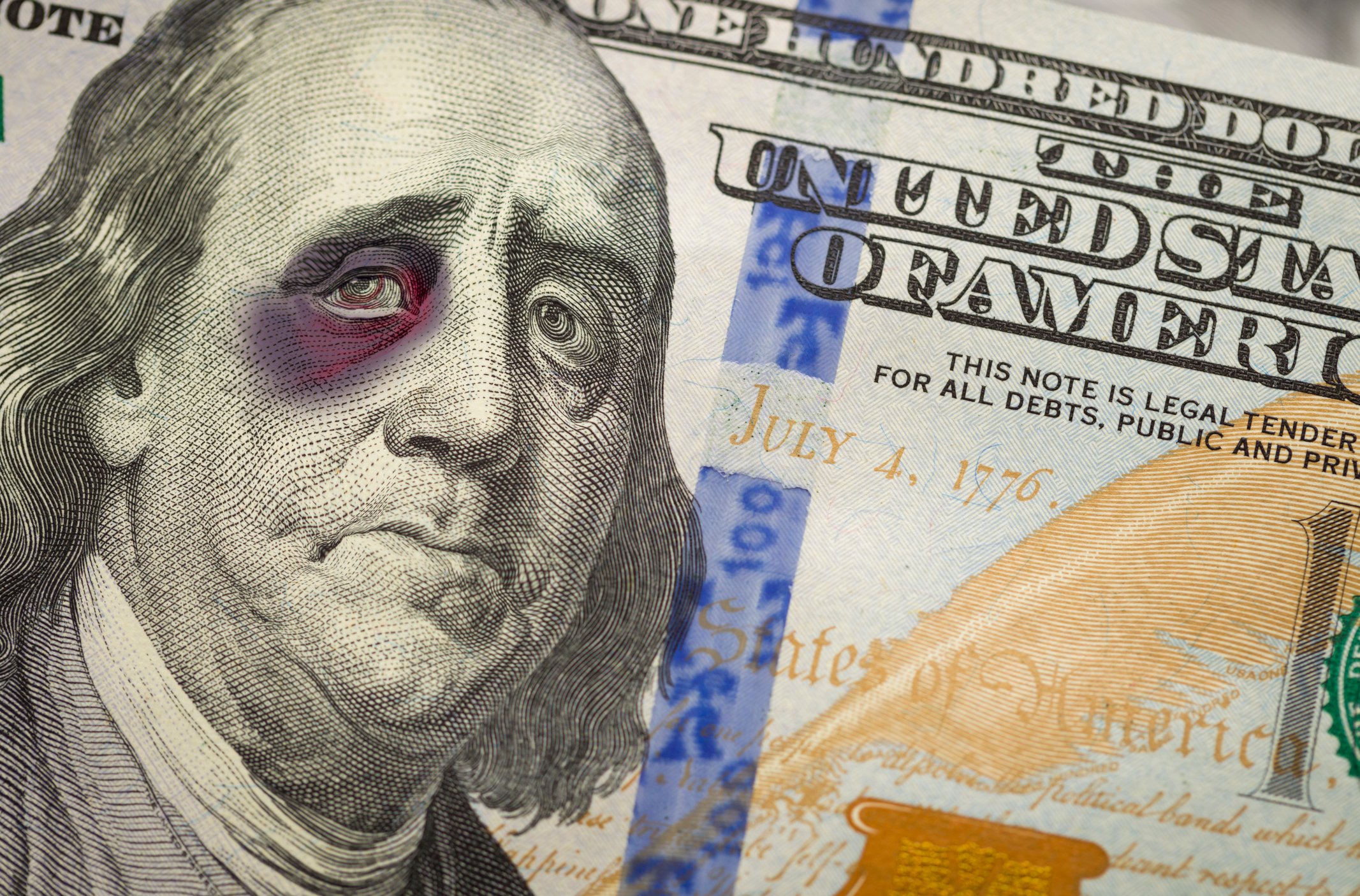 Benjamin Franklin with a bruised eye appearing on the $100 bill.