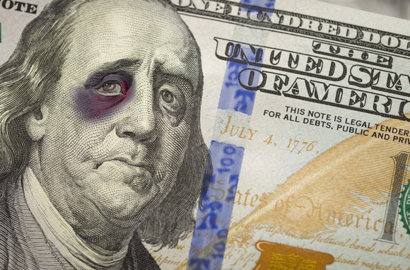 Benjamin Franklin with a bruised eye appearing on the $100 bill.