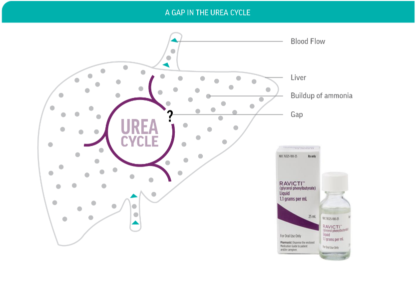 Ravicti - gap in urea cycle