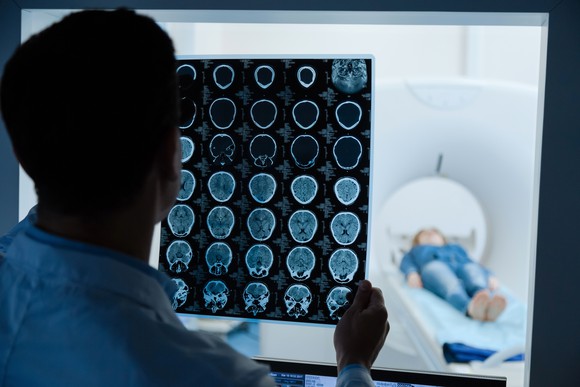 Professional male oncologist looking at the MRI scan image. 