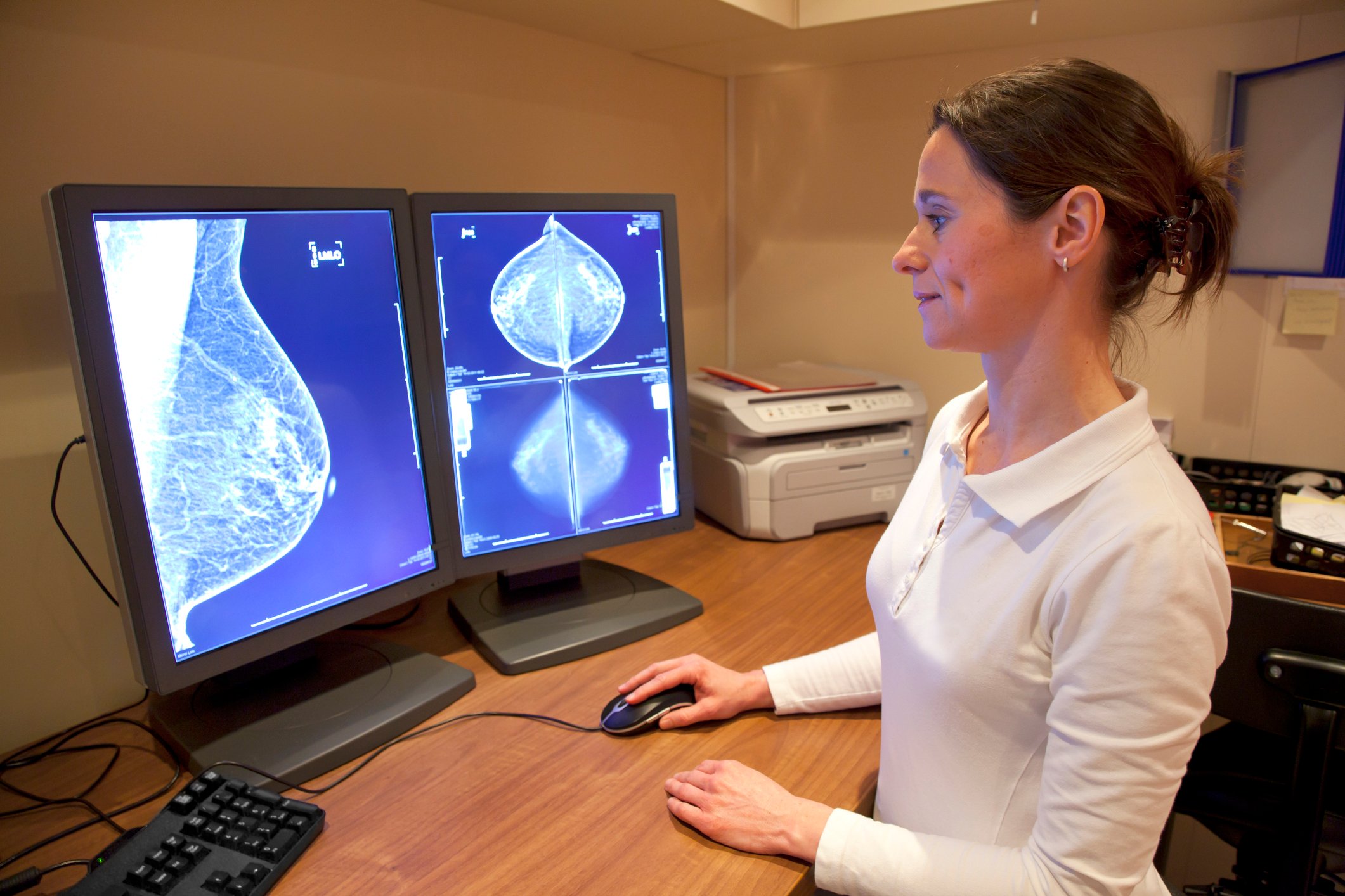 Doctor looking at a mammogram