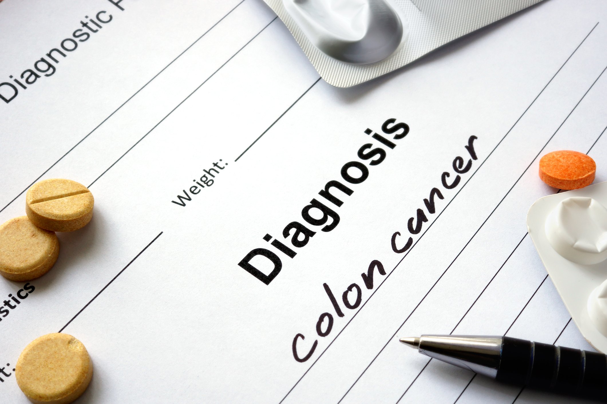 Colon cancer