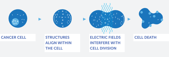 graphic of TTFields effect on cancerous cell
