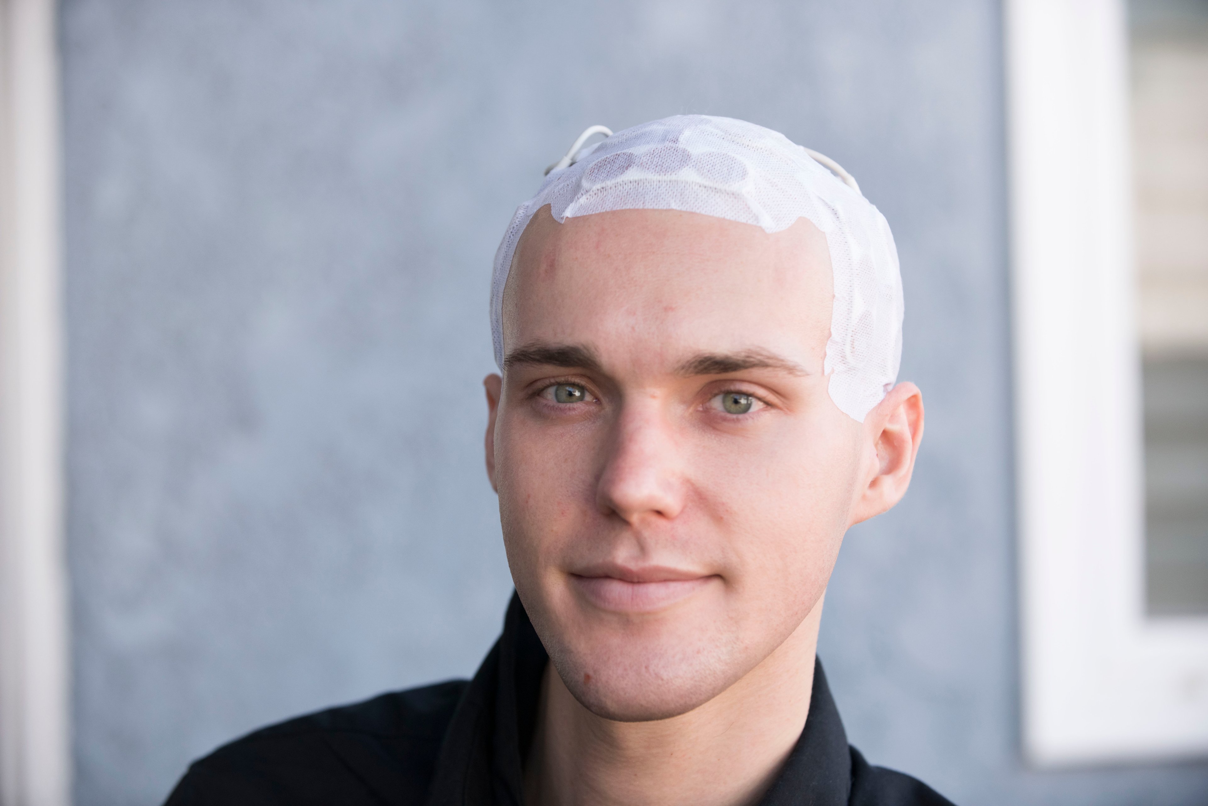 patient wearing Optune on head