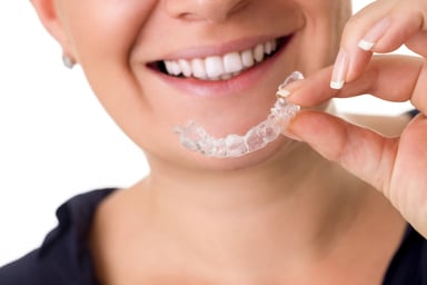ALGN invisible braces
