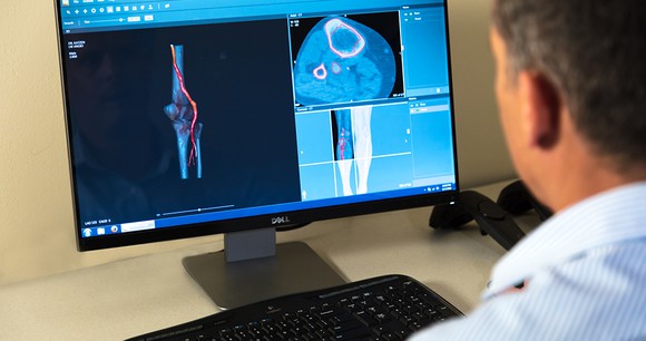 Male medical professional looking at 3D images of anatomical parts on a computer screen.