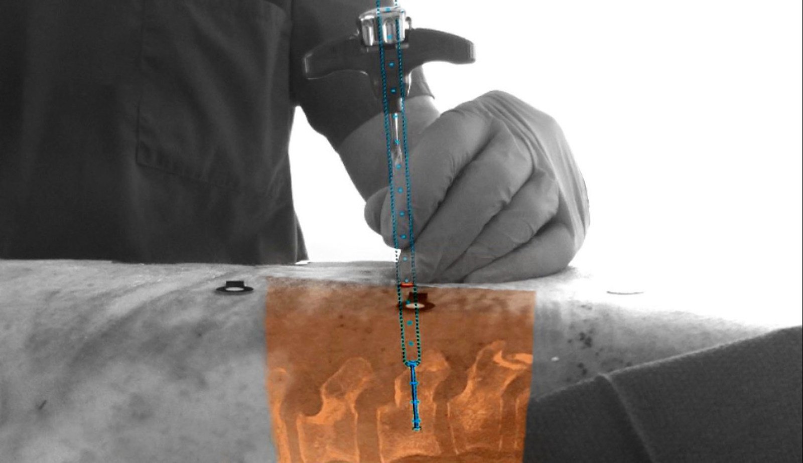 A surgeon inserting a tool into a body with the x-ray of the insides visible.