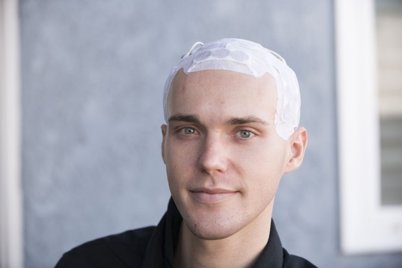 A patient wearing Optune on his head