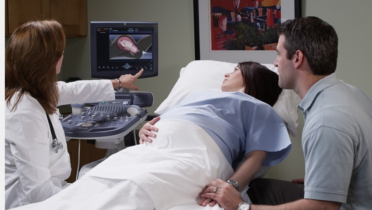 a doctor showing a pregnant woman her baby on a GE scanner